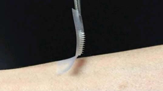 Akilli insulin bandi