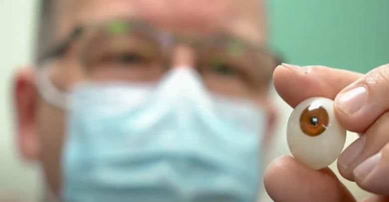 3D yazıcılı protez göz